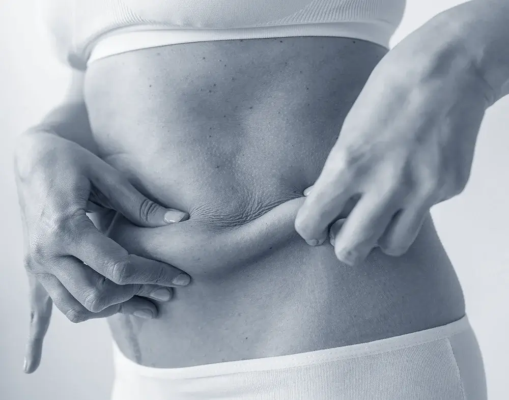 Adipose Tissue Derived Stem Cells